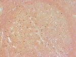 PARP1 (cleaved Asp214, Asp215) Polyclonal Antibody