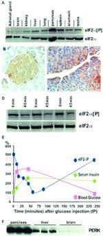 Phospho-EIF2S1 (Ser52) Antibody in Western Blot (WB)