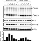 Phospho-EIF2S1 (Ser52) Antibody in Western Blot (WB)
