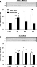 Phospho-EIF2S1 (Ser52) Antibody in Western Blot (WB)