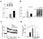 Phospho-EIF2S1 (Ser52) Antibody in Western Blot (WB)