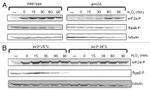 Phospho-EIF2S1 (Ser52) Antibody in Western Blot (WB)