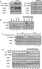 Phospho-EIF2S1 (Ser52) Antibody in Western Blot (WB)
