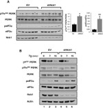 Phospho-EIF2S1 (Ser52) Antibody in Western Blot (WB)