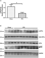 Phospho-EIF2S1 (Ser52) Antibody in Western Blot (WB)