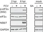 Phospho-EIF2S1 (Ser52) Antibody in Western Blot (WB)