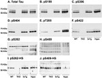 Phospho-Tau (Ser396) Antibody in Western Blot (WB)