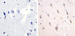 Phospho-Tau (Thr217) Polyclonal Antibody