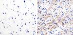 Phospho-Tau (Ser262) Polyclonal Antibody