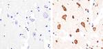 Phospho-Tau (Ser404) Antibody in Immunohistochemistry (Paraffin) (IHC (P))