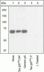 Phospho-Tau (Ser422) Polyclonal Antibody