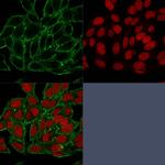 Moesin Monoclonal Antibody (MSN/493)