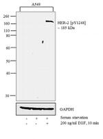 Phospho-ErbB2 (HER-2) (Tyr1248) Antibody in Western Blot (WB)