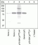 Phospho-p70 S6 Kinase (Thr389) Polyclonal Antibody