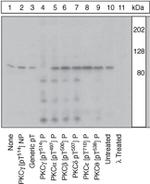 Phospho-PKC gamma (Thr514) Antibody