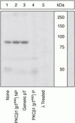 Phospho-PKC beta-1 (Thr642) Polyclonal Antibody