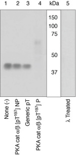 Phospho-PKC beta-2 (Thr641) Polyclonal Antibody