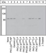 Phospho-PKC gamma (Thr655) Antibody