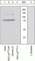 Phospho-PKC lambda/iota (Thr557, Thr564) Polyclonal Antibody