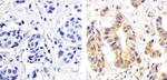 Phospho-PKC delta (Ser664) Polyclonal Antibody