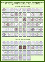 MTAP (Tumor Suppressor Marker) Recombinant Rabbit Monoclonal Antibody (MSVA-741R)