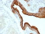 MUC1/CA15-3/EMA/CD227 (Epithelial Marker) Antibody in Immunohistochemistry (Paraffin) (IHC (P))