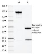 MUC1/CA15-3/EMA/CD227 (Epithelial Marker) Antibody in SDS-PAGE (SDS-PAGE)