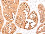 MUC1/CA15-3/EMA/CD227 Antibody in Immunohistochemistry (Paraffin) (IHC (P))