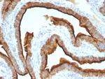 MUC1/CA15-3/EMA/CD227 Antibody in Immunohistochemistry (Paraffin) (IHC (P))