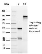 MUC1/CA15-3/EMA/CD227 (Epithelial Marker) Antibody in SDS-PAGE (SDS-PAGE)