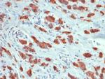 MUC1/CA15-3/EMA/CD227 Antibody in Immunohistochemistry (Paraffin) (IHC (P))