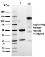 MUC1/CA15-3/EMA/CD227 Antibody in SDS-PAGE (SDS-PAGE)