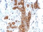 MUC1/CA15-3/EMA/CD227 (Epithelial Marker) Antibody in Immunohistochemistry (Paraffin) (IHC (P))