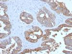 MUC1/CA15-3/EMA/CD227 (Epithelial Marker) Antibody in Immunohistochemistry (Paraffin) (IHC (P))