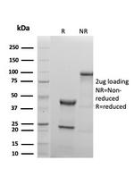 MUC1/CA15-3/EMA/CD227 (Epithelial Marker) Antibody in SDS-PAGE (SDS-PAGE)