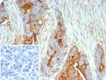 MUC1/CA15-3/EMA/CD227 (Epithelial Marker) Antibody in Immunohistochemistry (Paraffin) (IHC (P))
