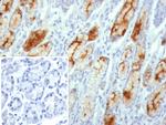 MUC1/CA15-3/EMA/CD227 (Epithelial Marker) Antibody in Immunohistochemistry (Paraffin) (IHC (P))