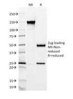 MUC2 (Mucin 2) Antibody in SDS-PAGE (SDS-PAGE)
