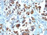 MUC3 (Mucin 3) Antibody in Immunohistochemistry (Paraffin) (IHC (P))