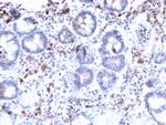 MUC3 (Mucin 3) Recombinant Rabbit Monoclonal Antibody (MUC3, 2992R)