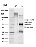 MUC4 (Mucin 4/Gastric Mucin) Antibody in SDS-PAGE (SDS-PAGE)