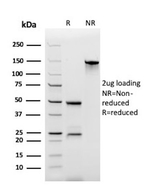 MUC4 (Mucin 4/Gastric Mucin) Antibody in SDS-PAGE (SDS-PAGE)