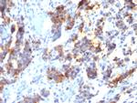 MUC5AC (Mucin 5AC/Gastric Mucin) Monoclonal Antibody (45M1)