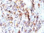MUC5AC (Mucin 5AC/Gastric Mucin) Monoclonal Antibody (SPM297)