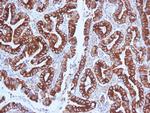 MUC5AC (Mucin 5AC/Gastric Mucin) Monoclonal Antibody (CLH2)