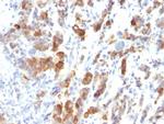 MUC5AC (Mucin 5AC/Gastric Mucin) Monoclonal Antibody (MUC5AC, 917)