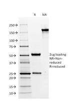 MUC6 (Mucin 6/Gastric Mucin) Antibody in SDS-PAGE (SDS-PAGE)