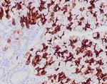 MUC6 (Mucin 6/Gastric Mucin) Monoclonal Antibody (CLH5)