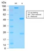 MUC6 (Mucin 6/Gastric Mucin) Antibody in SDS-PAGE (SDS-PAGE)