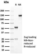 MUC6 (Mucin 6/Gastric Mucin) Antibody in SDS-PAGE (SDS-PAGE)
